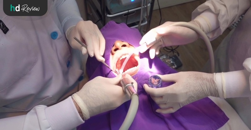 ขั้นตอนการฟอกฟันขาวที่ Let's Smile Dental Clinic