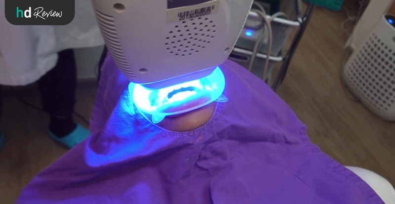 ขั้นตอนการฟอกฟันขาว Let's Smile Dental Clinic